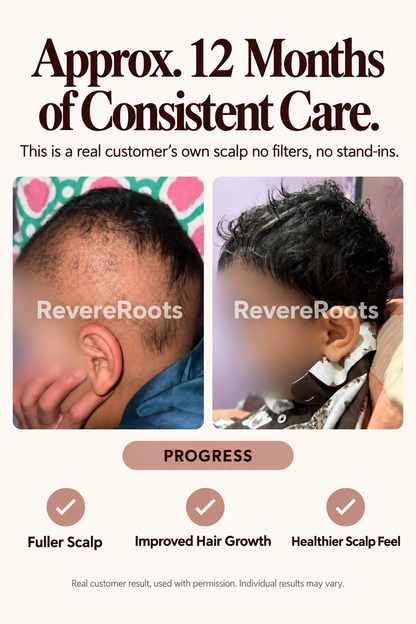 Root Revival Drops